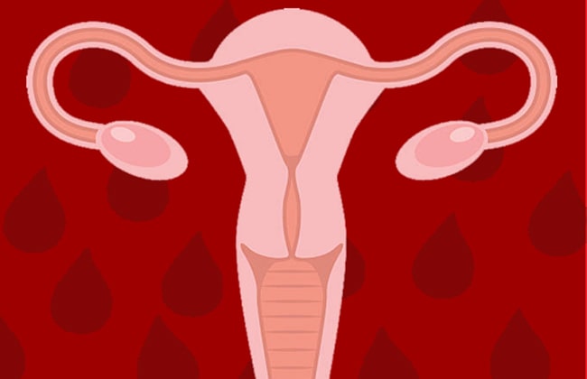 Menstruasiya şəkil